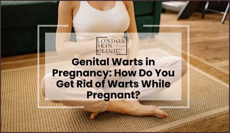 Can genital warts appear during pregnancy?